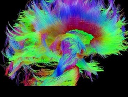 İnsan Beyninin En Ayrıntılı Görüntüleri Yayınlandı