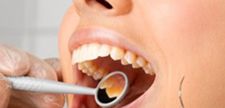 Ispartalıların "Sarı Diş" Sorunu