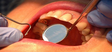 Diş Hekimi Pınar Kahraman'ın diş sağlımız için verdiği öneriler