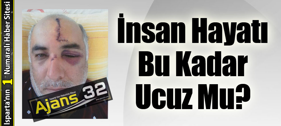 Öldüresiye Dövdüler!