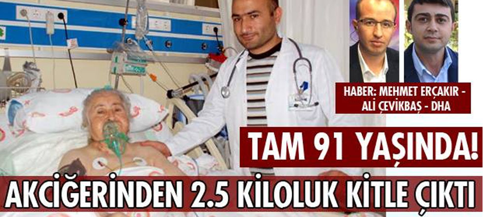 Akciğerinden 2.5 Kiloluk Kitle Çıktı