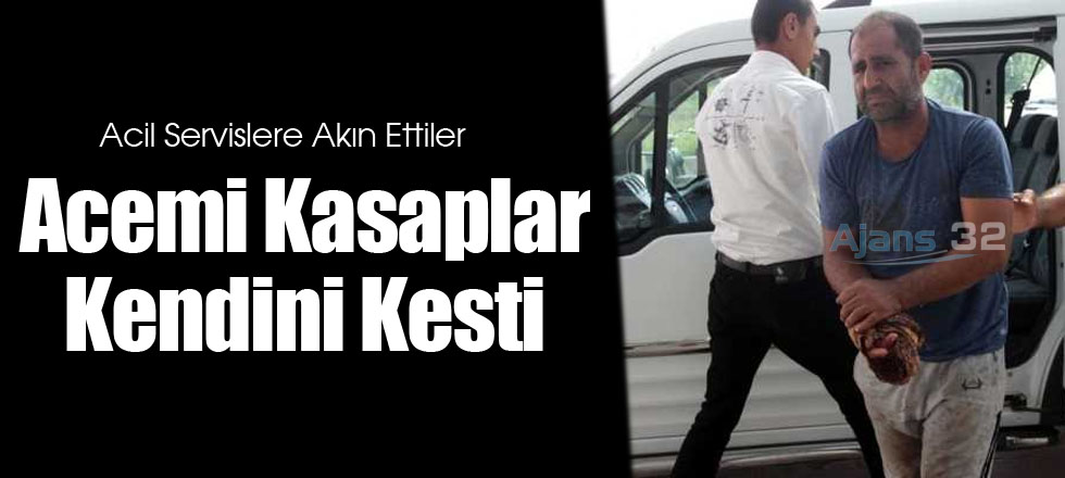 Acemi Kasaplar Kendini Kesti
