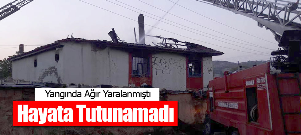 Yangında Ağır Yaralanmıştı / Hayata Tutunamadı