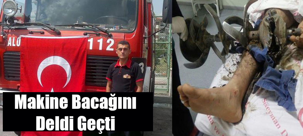 Makine Bacağını Deldi