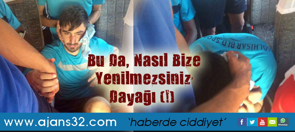 Bu Da, ‘Nasıl Bize Yenilmezsiniz’ Dayağı (!)