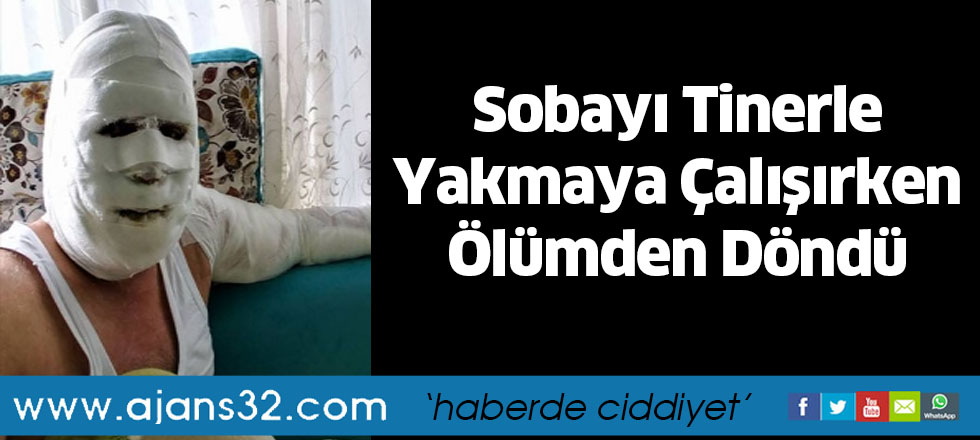 Sobayı Tinerle Yakmaya Çalışırken Ölümden Döndü