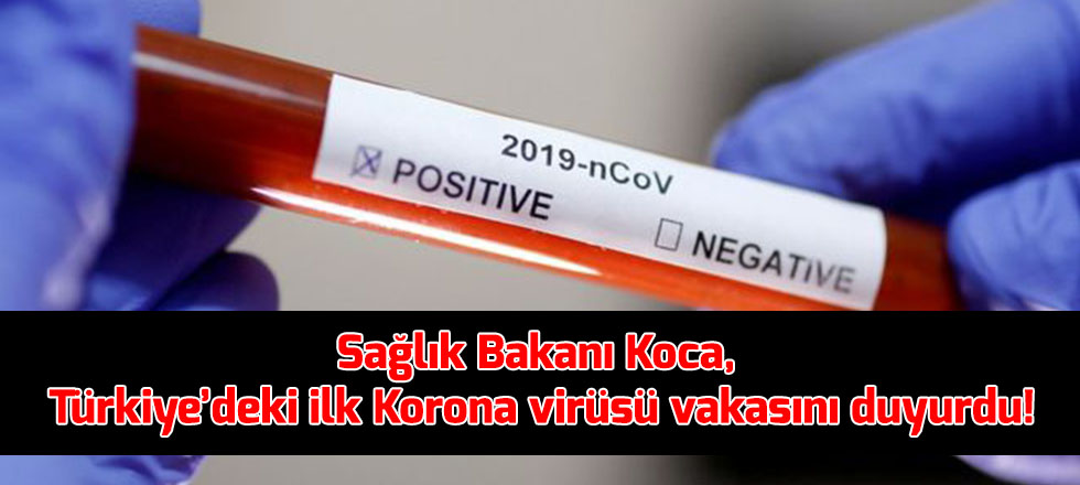 Koronovirüs Türkiye'de: 1 Kişinin Testi Pozitif