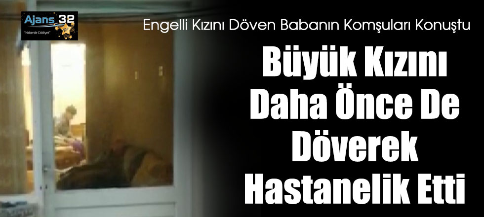 Büyük Kızını Daha Önce De Döverek Hastanelik Etti