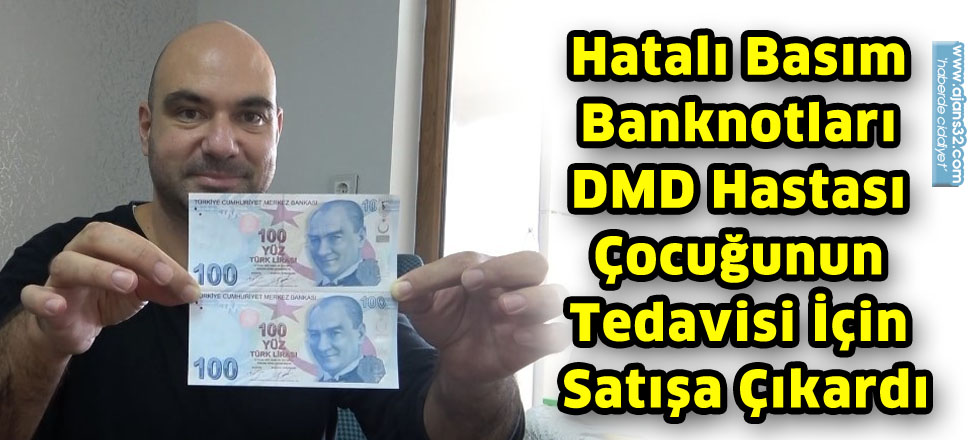 Hatalı Basım Banknotları DMD Hastası Çocuğunun Tedavisi İçin Satışa Çıkardı