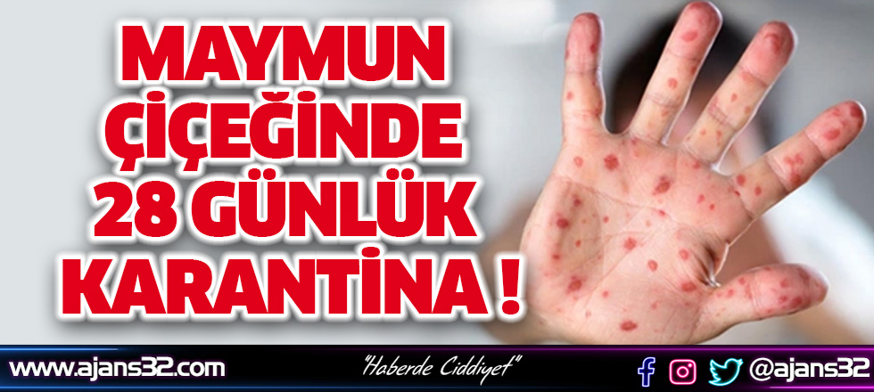 Maymun Çiçeğinde 28 Günlük Karantina !