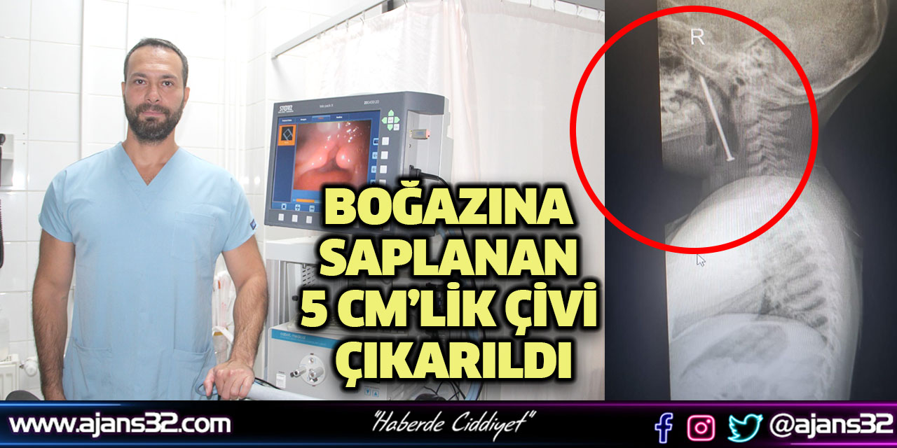 Boğazına Saplanan 5 Cm’lik Çivi Çıkarıldı