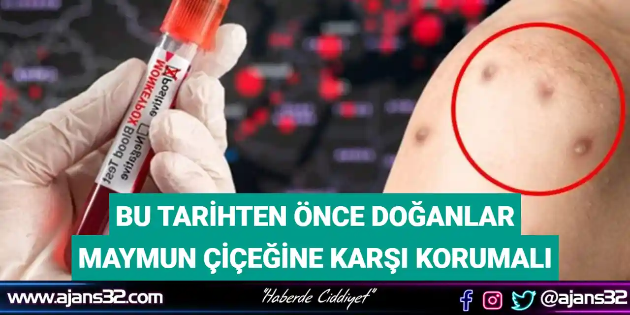 Bu Tarihten Önce Doğanlar Maymun Çiçeğine Karşı Korumalı