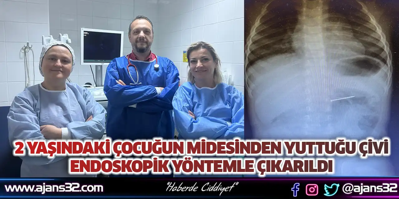 2 Yaşındaki Çocuğun Midesinden Yuttuğu Çivi Endoskopik Yöntemle Çıkarıldı