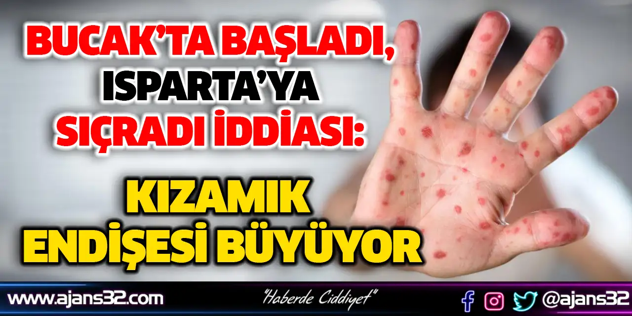 Bucak’ta Başladı, Isparta’ya Sıçradı İddiası: Kızamık Endişesi Büyüyor