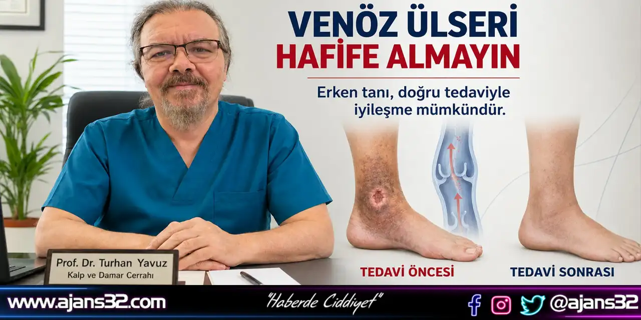 Venöz Ülseri Hafife Almayın