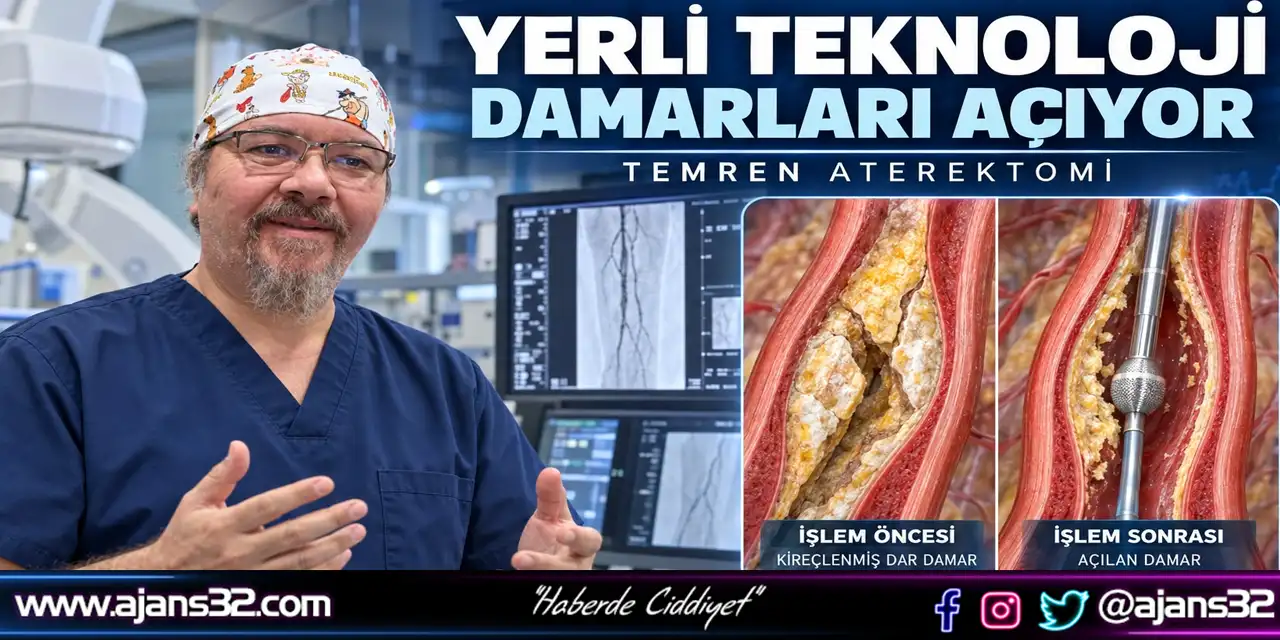 Yerli Teknoloji Damarları Açıyor: TEMREN Aterektomi