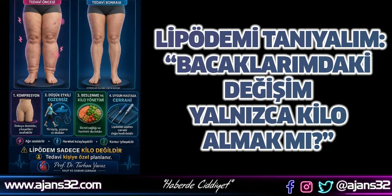 Lipödemi Tanıyalım: “Bacaklarımdaki Değişim Yalnızca Kilo Almak Mı?”