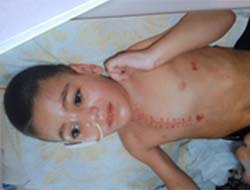 3 Hastaneden Geçti; Sonuç Bu